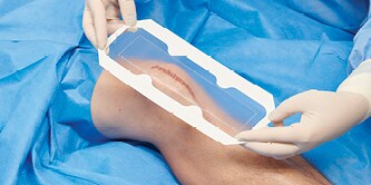 application of Tegaderm Absorbent Clear Acrylic Dressing on a knee incision
