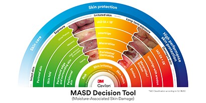 Image showing how the MASD tool works
