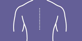 Prevena™ Therapy
