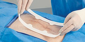 A surgeon applies a clear wound dressing to a surgical incision
