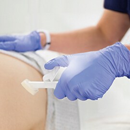 Cavilon Advanced Skin Protectant used on a patient