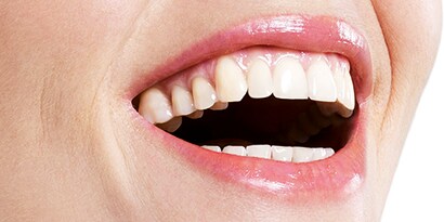 large smile

