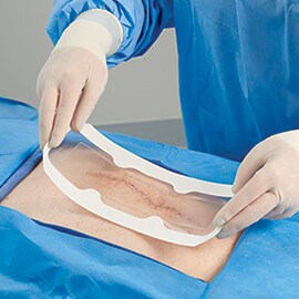 A surgeon applies a clear wound dressing to a surgical incision