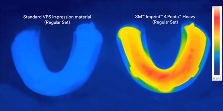  3M Imprint 4 VPS material - Active self-warming
