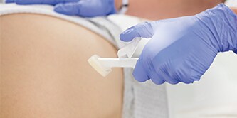 Cavilon Advanced Skin Procectant used on a patient
