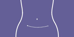 Prevena RESTOR

