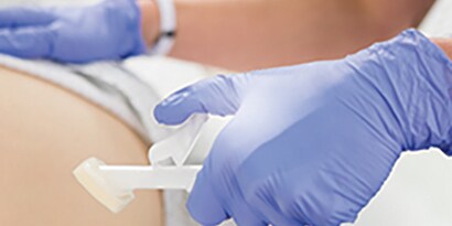 Cavilin Advanced Skin Protectant used on patient
