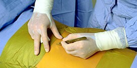 Incision Management 

