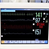 ECG Monitioring Alarms